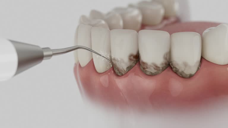 Trusted Root Canal Treatment service in Smyrna, GA - Dentist Open Now